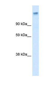 CACNA2D1 antibody LS-B162 Western blot of Fetal muscle lysate.