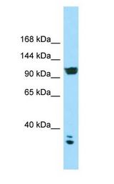 CACNA2D2 antibody Western Blot of HCT15.