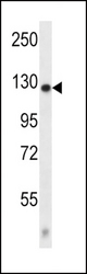 CACNA2D2 Antibody western blot of mouse kidney tissue lysates (35 ug/lane). The CACNA2D2 antibody detected the CACNA2D2 protein (arrow).
