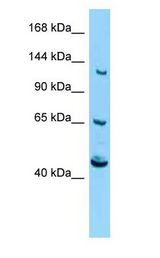 CACNA2D4 antibody Western Blot of Mouse Pancreas.