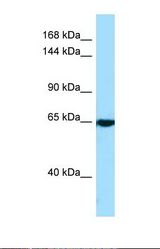 Western blot of Human A549. CACNA2D4 antibody dilution 1.0 ug/ml.