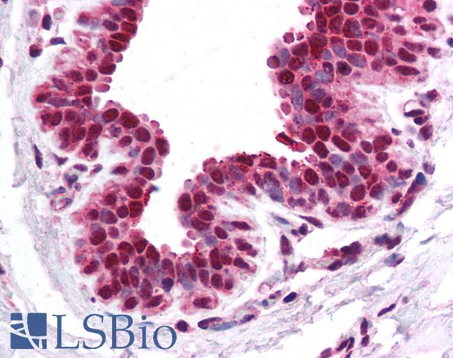 Anti-CACNB1 antibody IHC of human breast. Immunohistochemistry of formalin-fixed, paraffin-embedded tissue after heat-induced antigen retrieval. Antibody LS-B926 concentration 5 ug/ml.