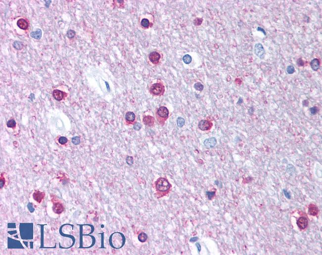 Anti-CACNB1 antibody IHC of human brain, cortex, white matter. Immunohistochemistry of formalin-fixed, paraffin-embedded tissue after heat-induced antigen retrieval. Antibody LS-B926 concentration 5 ug/ml.