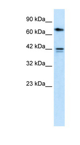 CACNB1 antibody LS-B926 Western blot of HepG2 cell lysate.