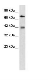 HepG2 Cell Lysate