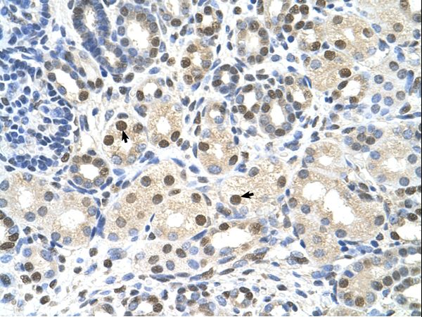 CACNB1 antibody LS-C40298 was used in IHC to stain formalin-fixed, paraffin-embedded human kidney.