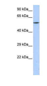 CACNB1 antibody LS-C110196 Western blot of MCF7 cell lysate.