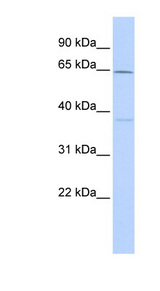 CACNB1 antibody LS-C109985 Western blot of Fetal Brain lysate.