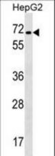 CACNB1 Antibody western blot of HepG2 cell line lysates (35 ug/lane). The CACNB1 antibody detected the CACNB1 protein (arrow).