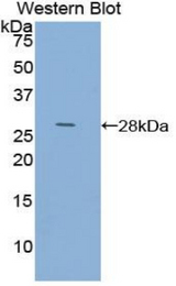 Western blot of recombinant ACTC1 / Alpha Cardiac Actin.