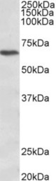 CACNB2 antibody (1 ug/ml) staining of Jurkat lysate (35 ug protein in RIPA buffer). Primary incubation was 1 hour. Detected by chemiluminescence.