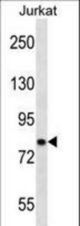 CACNB2 Antibody western blot of Jurkat cell line lysates (35 ug/lane). The CACNB2 antibody detected the CACNB2 protein (arrow).