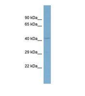Western blot of Human COLO205. CACNB2 antibody dilution 1.0 ug/ml.