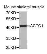 Western blot analysis of extracts of Mouse skeletal muscle cell line, using ACTC1 antibody.
