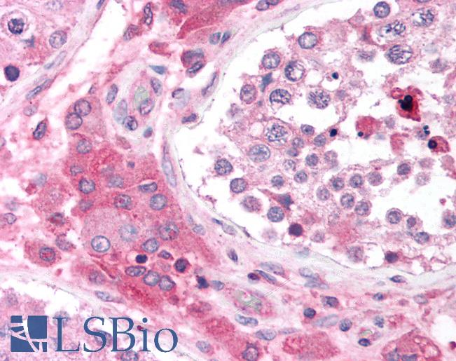 Anti-CACNB2 antibody IHC of human testis. Immunohistochemistry of formalin-fixed, paraffin-embedded tissue after heat-induced antigen retrieval. Antibody LS-B927 concentration 5 ug/ml.