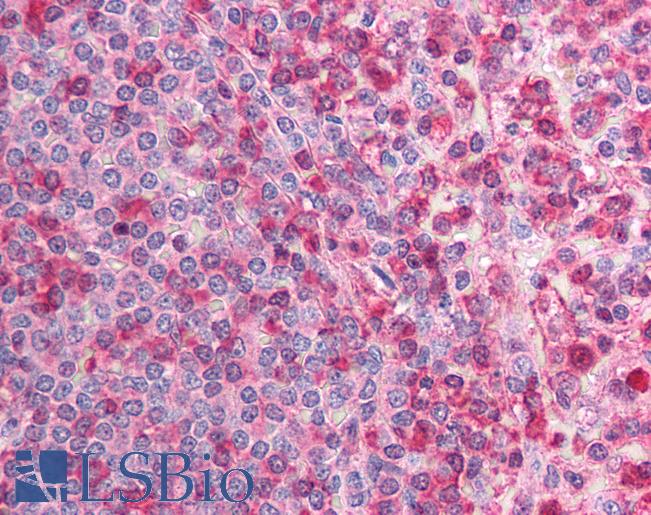 Anti-CACNB2 antibody IHC of human spleen. Immunohistochemistry of formalin-fixed, paraffin-embedded tissue after heat-induced antigen retrieval. Antibody LS-B927 concentration 5 ug/ml.