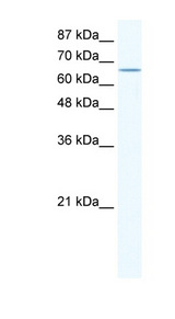 CACNB2 antibody LS-B927 Western blot of HepG2 cell lysate.