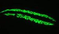 Immunofluorescence staining of developing myocardium in 1 month old zebrafish embryo