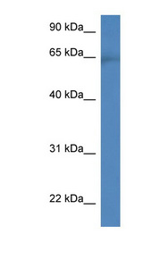 CACNB2 antibody LS-C135022 Western blot of HepG2 cell lysate.