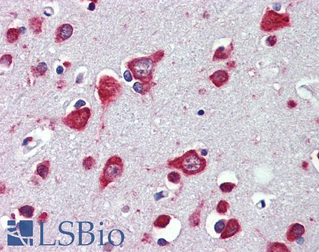 Anti-CACNB3 antibody IHC of human brain, cortex. Immunohistochemistry of formalin-fixed, paraffin-embedded tissue after heat-induced antigen retrieval. Antibody LS-B4127 concentration 3.75 ug/ml.