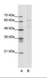A: Marker, B: Jurkat Cell Lysate