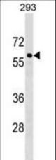 CACNB3 Antibody western blot of 293 cell line lysates (35 ug/lane). The CACNB3 antibody detected the CACNB3 protein (arrow).
