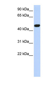 CACNB4 antibody LS-C110198 Western blot of MCF7 cell lysate.