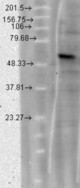 Cavbeta4 (S10-7), T-CHO induced.