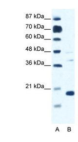 CACNG1 antibody LS-B928 Western blot of Jurkat lysate.