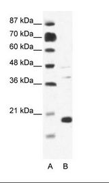 A: Marker, B: Jurkat Cell Lysate