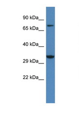 CACNG2 / Stargazin antibody LS-C145314 Western blot of Rat Liver lysate. Antibody concentration 1 ug/ml.