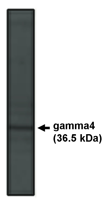 Western blot of 4 antibody on rat brain lysate at 5 ug/ml.