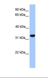 721_B cell lysate. Antibody concentration: 1.0 ug/ml. Gel concentration: 12%.