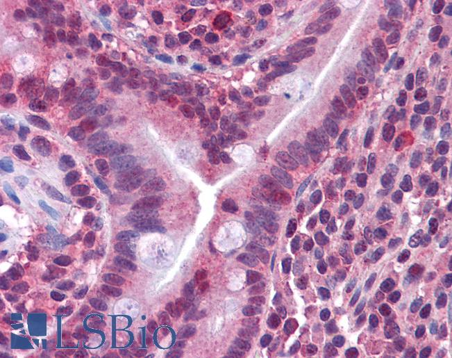 Anti-CACNG5 antibody IHC of human small intestine. Immunohistochemistry of formalin-fixed, paraffin-embedded tissue after heat-induced antigen retrieval. Antibody LS-B4222 concentration 10 ug/ml.