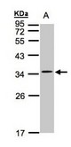 Sample(30 ug whole cell lysate). A: Hep G2. 12% SDS PAGE. CACNG5 antibody diluted at 1:1000.