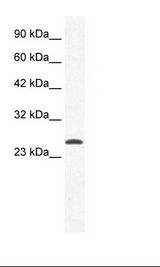 HepG2 Cell Lysate