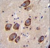 CACNG6 Antibody immunohistochemistry of formalin-fixed and paraffin-embedded human brain tissue followed by peroxidase-conjugated secondary antibody and DAB staining.