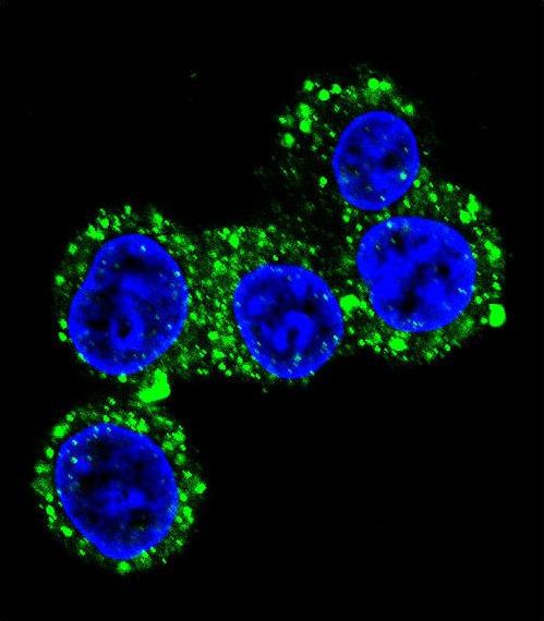 Confocal immunofluorescent of CACNG6 Antibody with HepG2 cell followed by Alexa Fluor 488-conjugated goat anti-rabbit lgG (green). DAPI was used to stain the cell nuclear (blue).