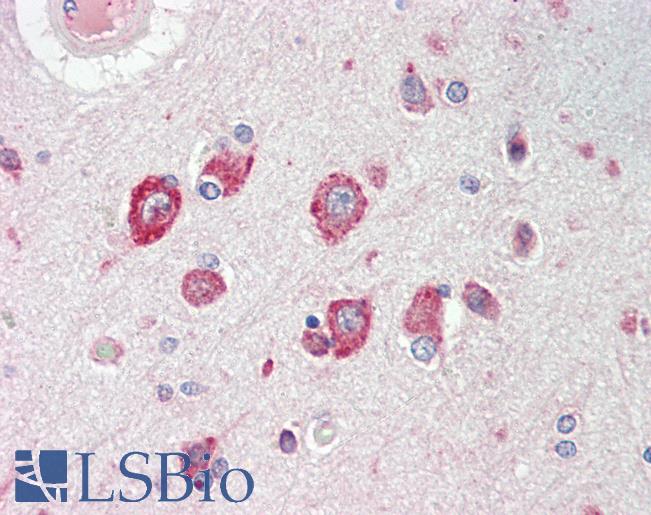 Anti-CACNG8 antibody IHC staining of human brain, cortex. Immunohistochemistry of formalin-fixed, paraffin-embedded tissue after heat-induced antigen retrieval.