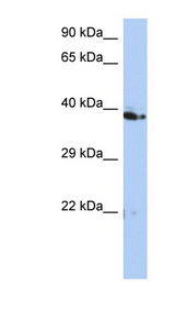 C10orf46 antibody LS-C111496 Western blot of HT1080 cell lysate.