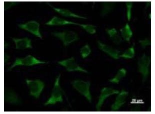 Immunofluorescent staining using CACYBP antibody. Immunostaining analysis in HeLa cells. HeLa cells were fixed with 4% paraformaldehyde and permeabilized with 0.01% Triton-X100 in PBS. The cells were immunostained with anti-CACYBP antibody.