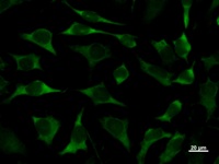 Immunostaining analysis in HeLa cells. HeLa cells were fixed with 4% paraformaldehyde and permeabilized with 0.1% Triton X-100 in PBS. The cells were immunostained with anti-CACYBP mAb.