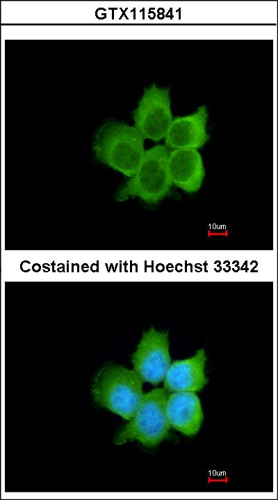 Immunofluorescence of paraformaldehyde-fixed A431 using CacyBP antibody at 1:200 dilution.