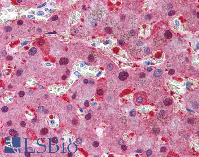 Anti-CAD antibody IHC of human liver. Immunohistochemistry of formalin-fixed, paraffin-embedded tissue after heat-induced antigen retrieval. Antibody LS-B4205 concentration 10 ug/ml.