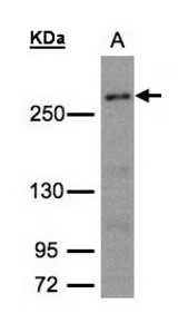 Sample (30g whole cell lysate). A:293T whole cell lysate. 5% SDS PAGE. CAD antibody diluted at 1:1500