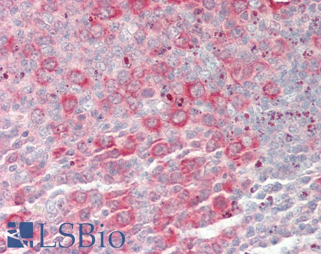 Human Tonsil: Formalin-Fixed, Paraffin-Embedded (FFPE)