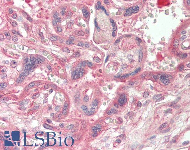 Human Placenta: Formalin-Fixed, Paraffin-Embedded (FFPE)
