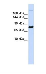 293T cell lysate. Anti-CAD Antibody concentration: 1.0 ug/ml. Gel concentration: 6-18%.