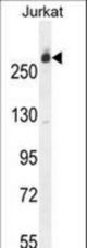 CAD Antibody western blot of Jurkat cell line lysates (35 ug/lane). The CAD antibody detected the CAD protein (arrow).