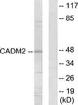 Western blot of extracts from HepG2 cells, using CADM2 Antibody. The lane on the right is treated with the synthesized peptide.